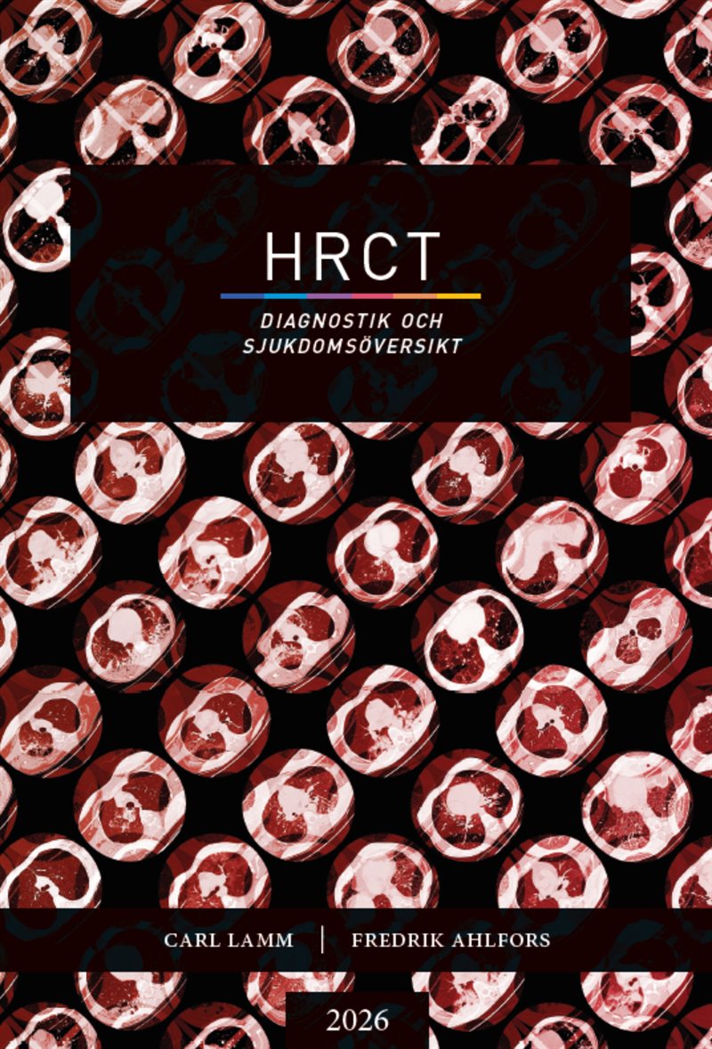 HRCT - Diagnostik och sjukdomsöversikt